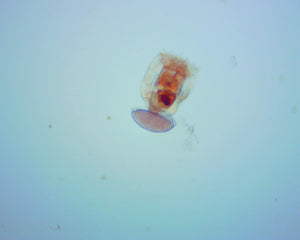 What are Rotifers?