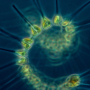 Phytoplankton – The Foundation of Your Reef’s Foodchain